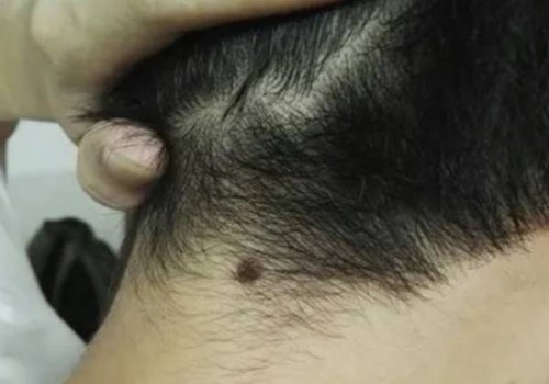 上海供卵代怀儿子：﻿早产儿护理常规一览，这四大护理措施宝妈要牢记